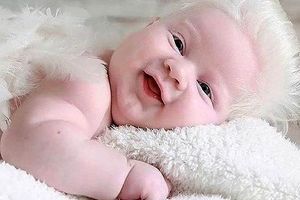 هر آنچه باید از مشکلات «زال ها» بدانید