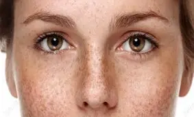 مشکلات پوستی در بارداری، شایع ترین ها