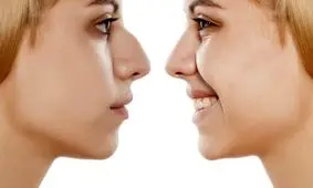 این هم عاقبت بچه پدر و مادر عملی!