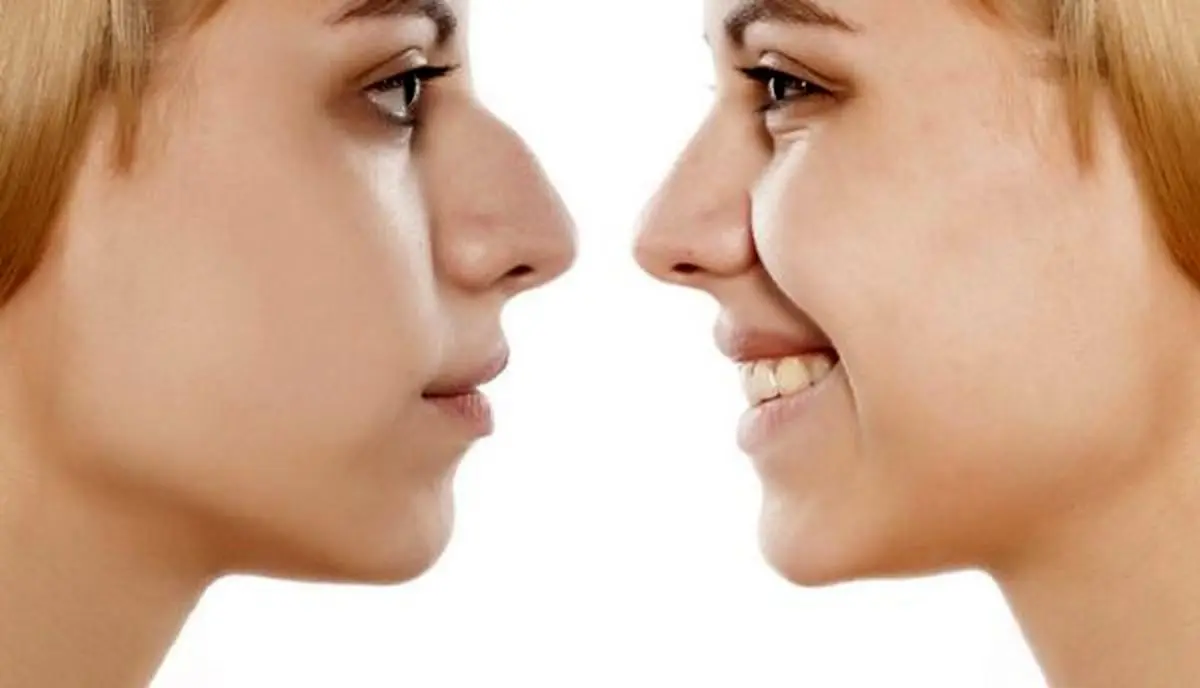 این هم عاقبت بچه پدر و مادر عملی!