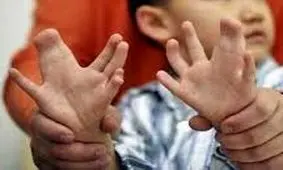 پیشگیری از ناهنجاری مادرزادی، تغذیه صحیح