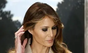 هشت عمل جراحی زن ۴۲ساله برای شبیه شدن به ملانیا ترامپ