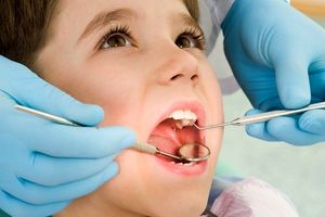 بحران بهداشت دهان و دندان به دلیل مصرف مواد خوراکی شیرین