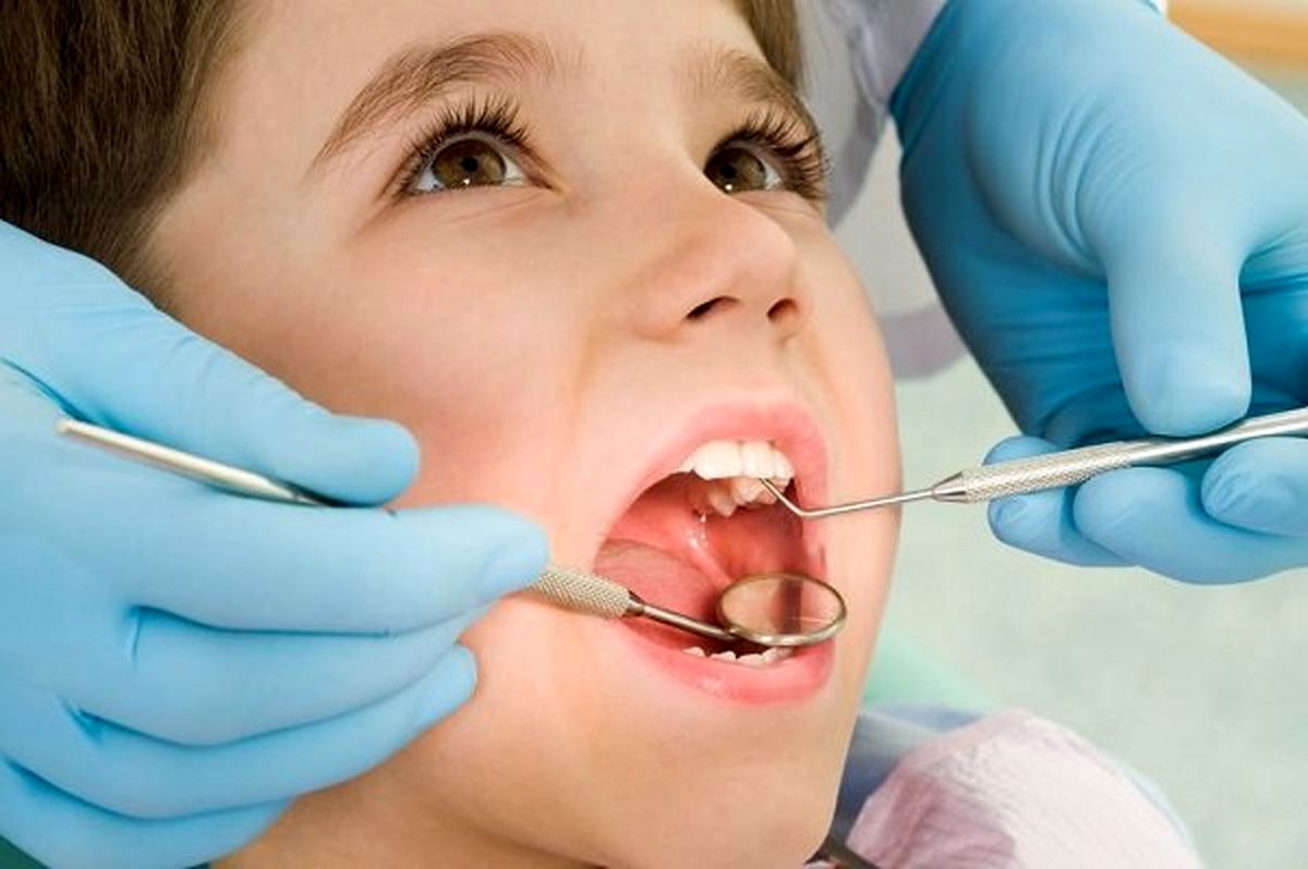 بحران بهداشت دهان و دندان به دلیل مصرف مواد خوراکی شیرین