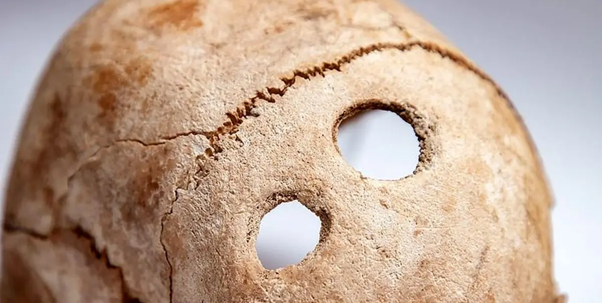 کشف سوراخ در جمجمه‌های باستانی+تصاویر