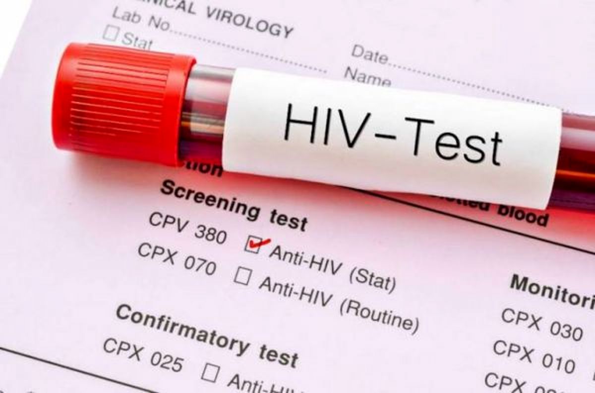 در مواجهه با فرد مبتلا به اچ‌آی‌وی چه می‌کنید؟