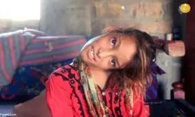 (تصاویر) چرخش عجیب سر یک دختر با زاویه ۹۰ درجه!