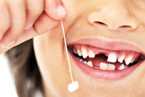 دندان‌های شیری را پیش از موعد نکشید