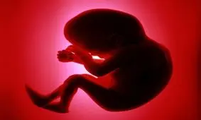 رشد مناسب جنین، تاثیر بهداشت دندان