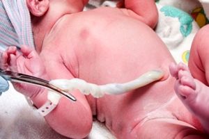 موارد استفاده از خون بند ناف نوزاد