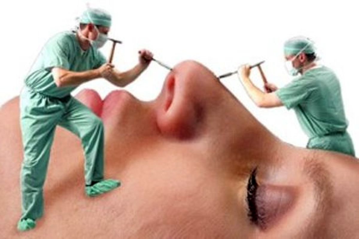 تبلیغات غیرقانونی اینستاگرامی و جراحی زیبایی در اتاق عملهای غیراستاندارد