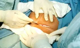 ویدئویی کوتاه برای تبلیغ زایمان طبیعی