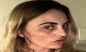 روش عجیب زن متقلب برای تامین هزینه جراحی بینی / از شکایت از وزارت بهداشت تا راه‌اندازی کمپین