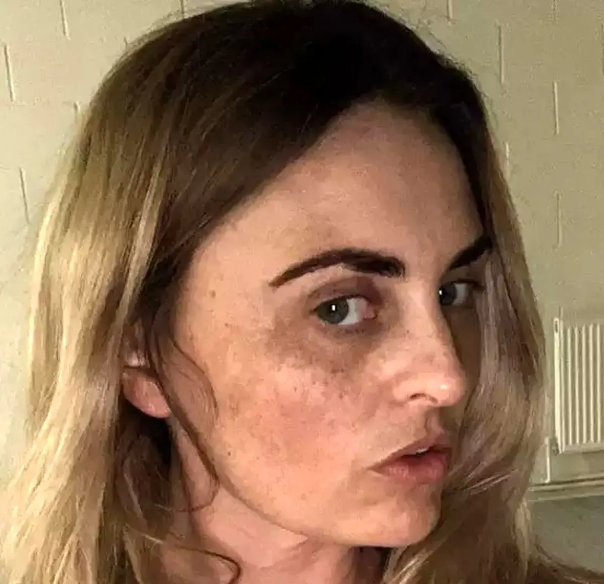 روش عجیب زن متقلب برای تامین هزینه جراحی بینی / از شکایت از وزارت بهداشت تا راه‌اندازی کمپین