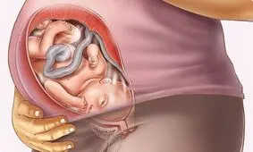 بارداری هفته به هفته، هفته سی و یکم