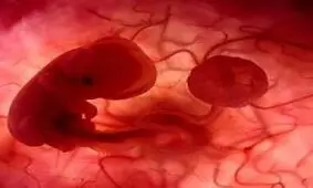 آزمایشات تشخیص دهنده علل مرده زایی