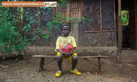 بیماری این پسر باعث شده خاص‌ترین چشم‌های جهان را داشته باشد! +تصاویر