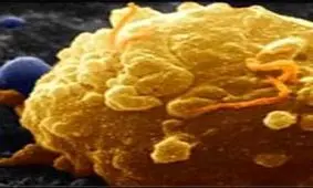 استفاده از فناوری نانو برای از بین بردن تومور سرطانی