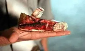 عکس‌هایی از انفجار شب گذشته در کابل