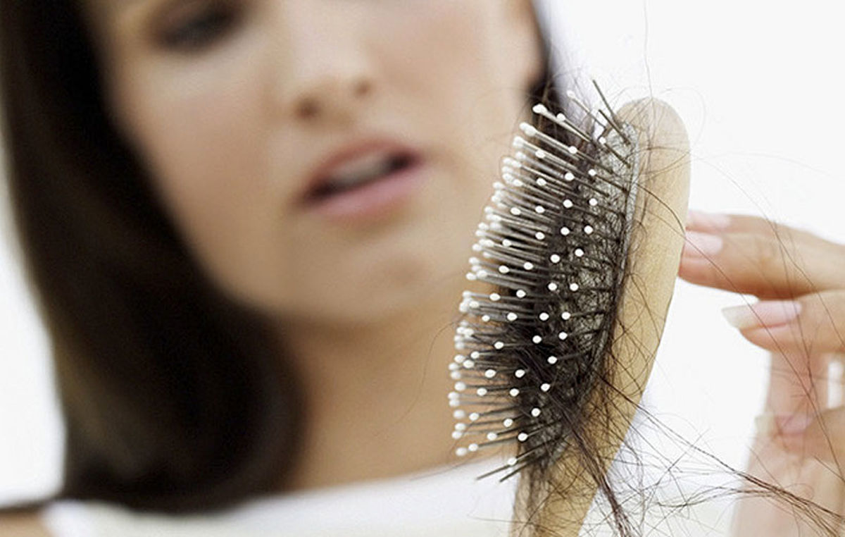 علل ریزش مو در خانم‌ها