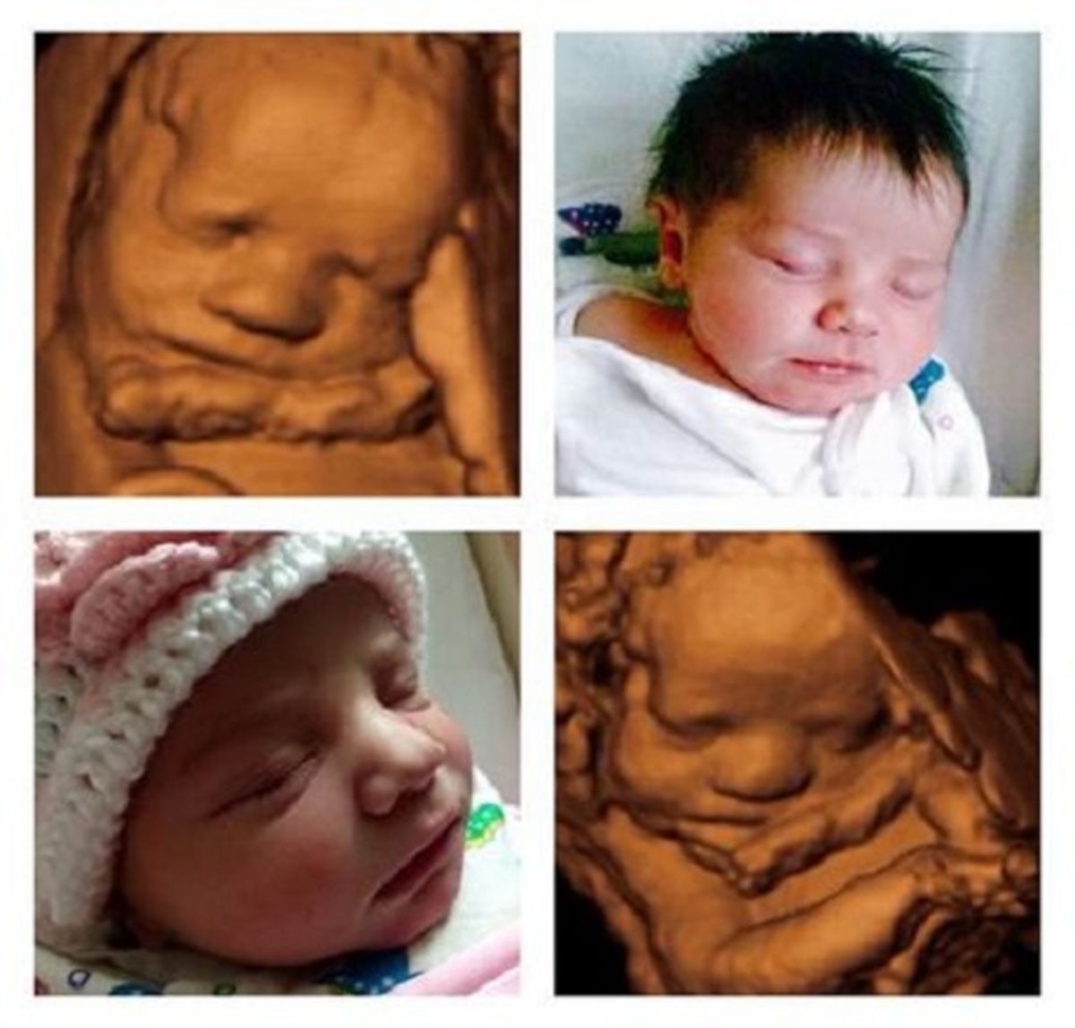 سونوگرافی سه بعدی جنین چیست؟