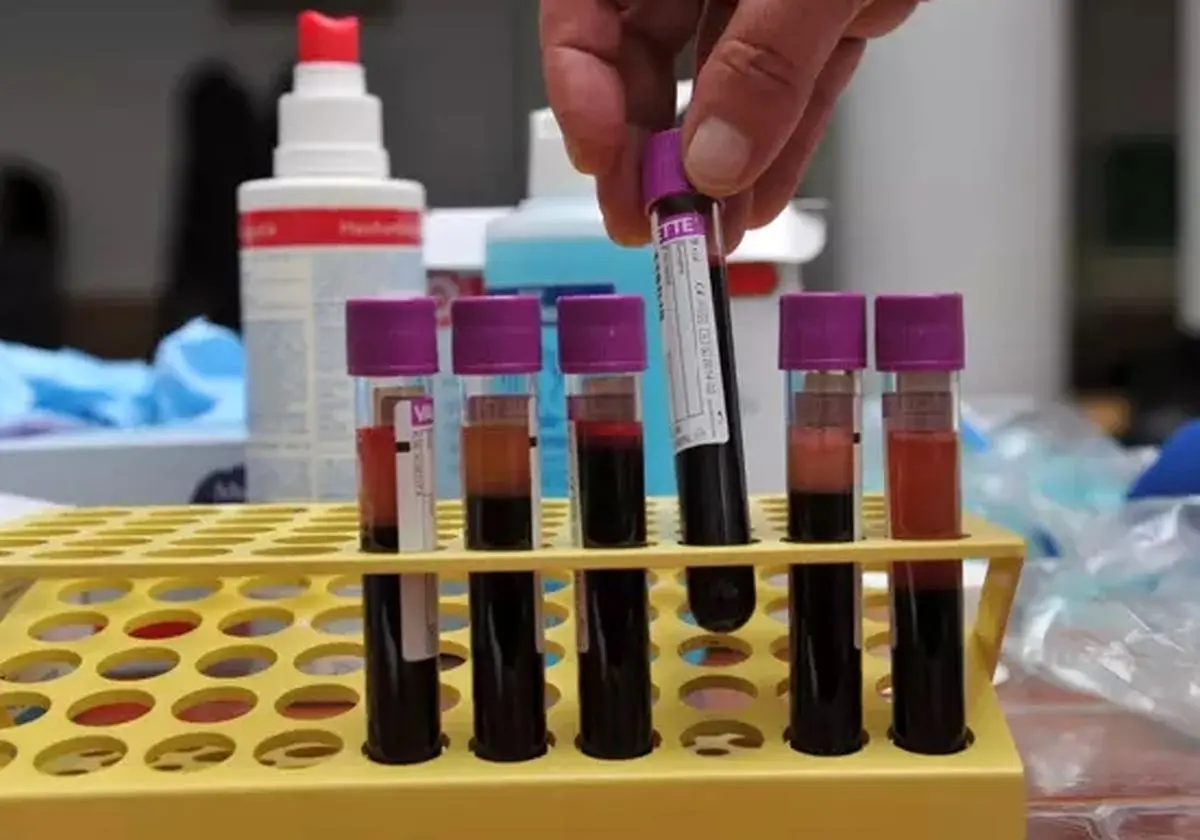با این آزمایش خون پیش‌بینی کنید ۱۰ سال بعد زنده‌اید یا خیر!