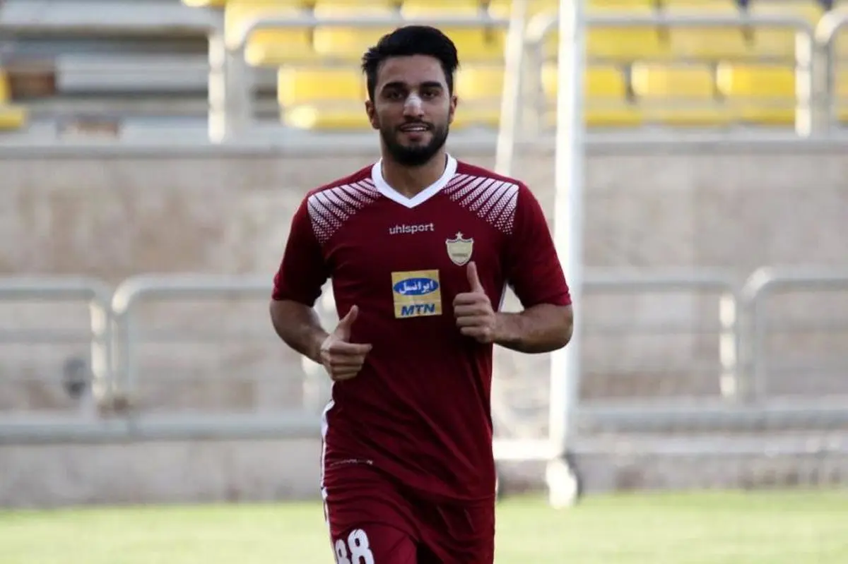 رونمایی از سیامک با بینی عمل شده!