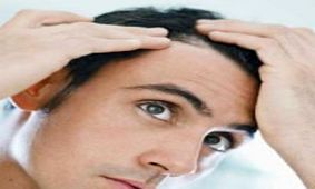 خطر طاسی زودرس در کدام مردان بیش تر است؟