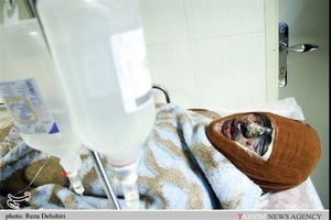 مواد منفجره دست ساز پای دو جوان همدانی را به بیمارستان کشاند