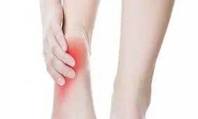 نکاتی که با رعایت آن‌ها خار پاشنه دیگر به سراغتان نمی‌آید/ چگونه خار پاشنه را بدون جراحی درمان کنیم؟