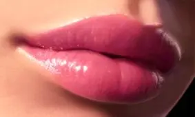 آنچه که باید درباره عمل پروتز لب بدانید