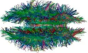 استفاده از اسکن ام.آر.آی برای تشخیص اچ.آی.وی