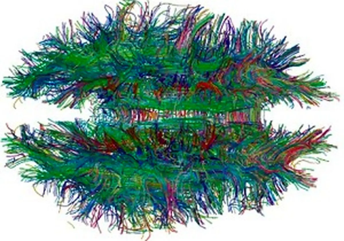 استفاده از اسکن ام.آر.آی برای تشخیص اچ.آی.وی