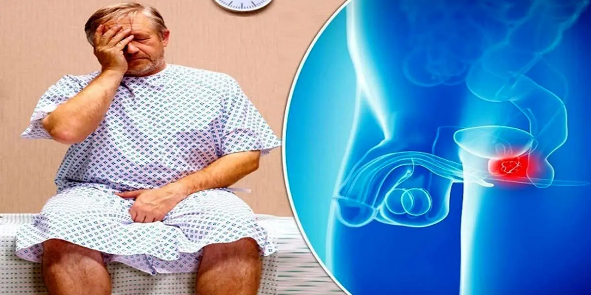 نكاتی كه هر زنی باید در مورد سرطان پروستات برای محافظت از عزیزان خود از آنها آگاهی داشته باشد