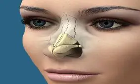 تشکیل پرونده برای دختر همدانی که زیر تیغ جراح بینی جان داد