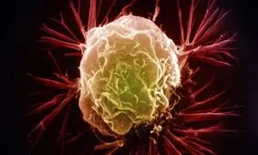 ساخت نانوذراتی که تومورهای عمیق را هدف می‌گیرد