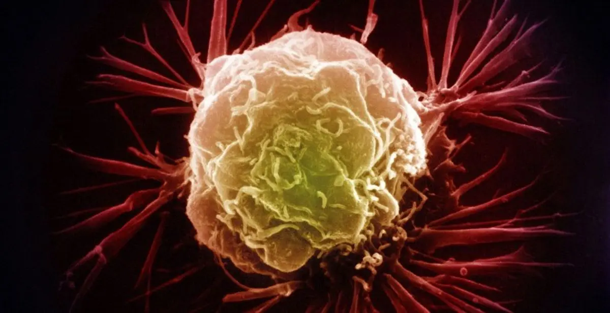 ساخت نانوذراتی که تومورهای عمیق را هدف می‌گیرد