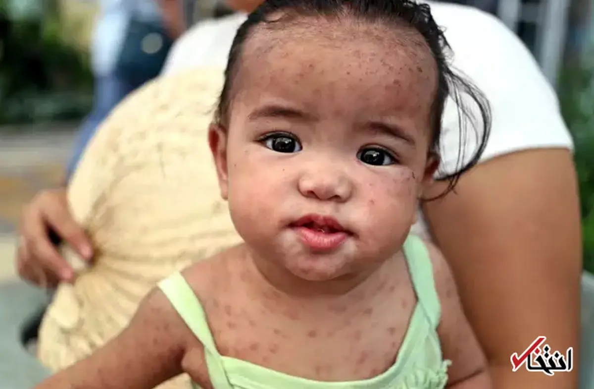 پشیمانی مادری که اجازه نداد پسرش تا پای مرگ واکسینه شود