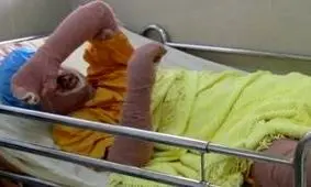 عکس‌هایی واقعی از چهره سحر خدایاری