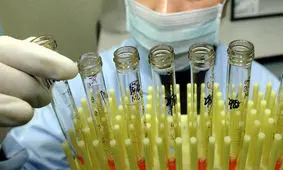 نمونه بزاق‌تان را بدهید و به شبکه اهداکنندگان سلول‌های بنیادی بپیوندید