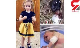 موش ها دستان این دختر خوش سیما را خوردند!