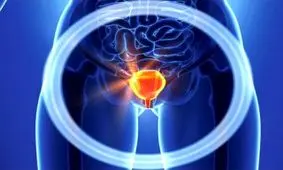 راه‌های جلوگیری از عفونت ادراری بعد از رابطه جنسی