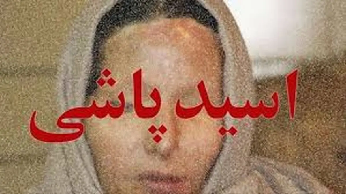 فاطمه زنی زیبارو بود که همسر برادرش سیمای او را از بین برد