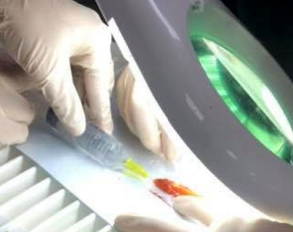 جراحی کمیاب و نجات بخش معده یک ماهی بسیار کوچک در انگلستان