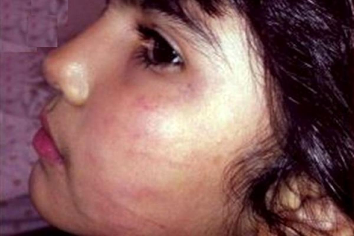 اقدام هولناک پزشک اصفهانی با دختر بچه در مطبش