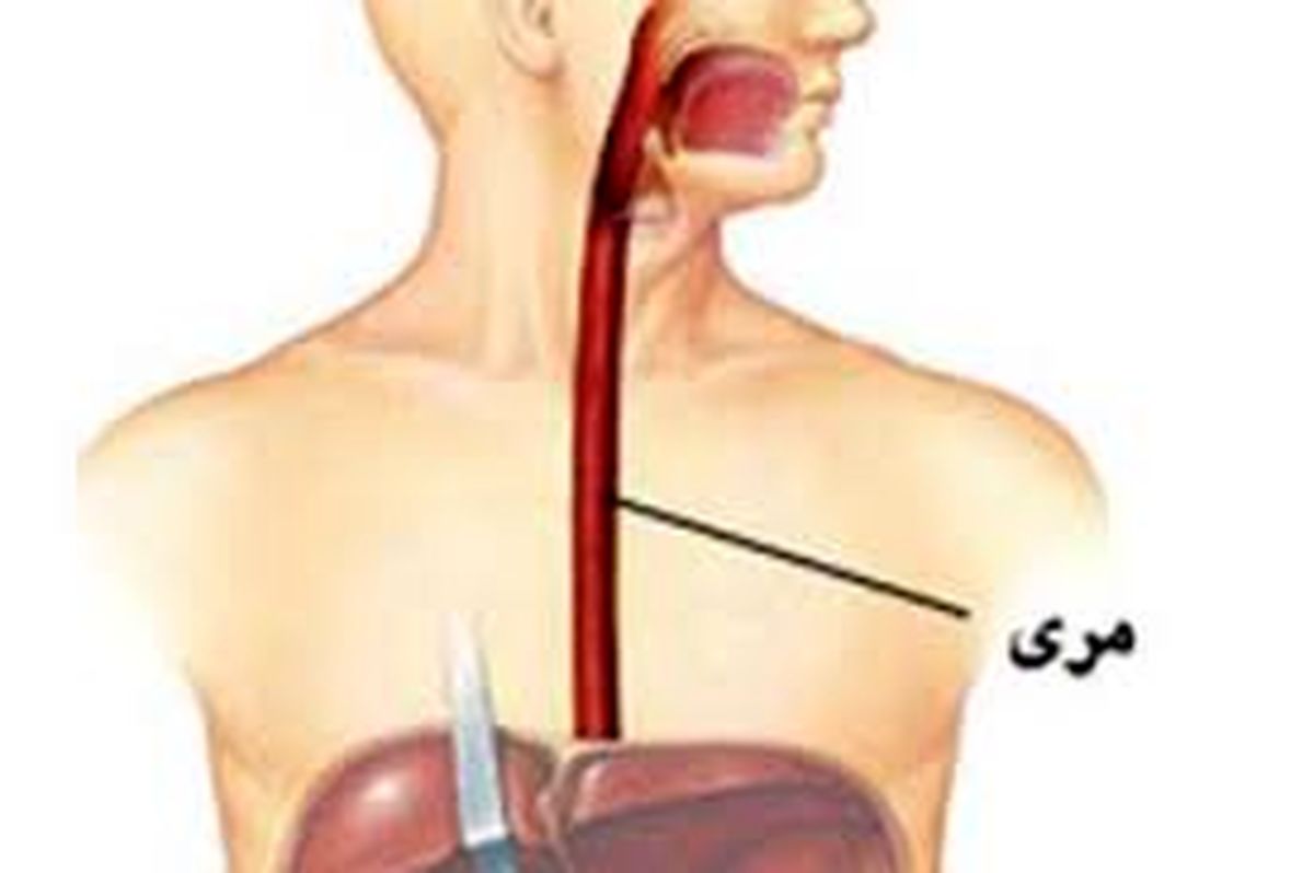 بیماری وحشتناک که مری را از بین میبرد + عکس