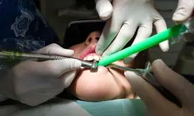 آغاز غربالگری سلامت دهان و دندان دانش‌آموزان ابتدایی از آبان‌ماه