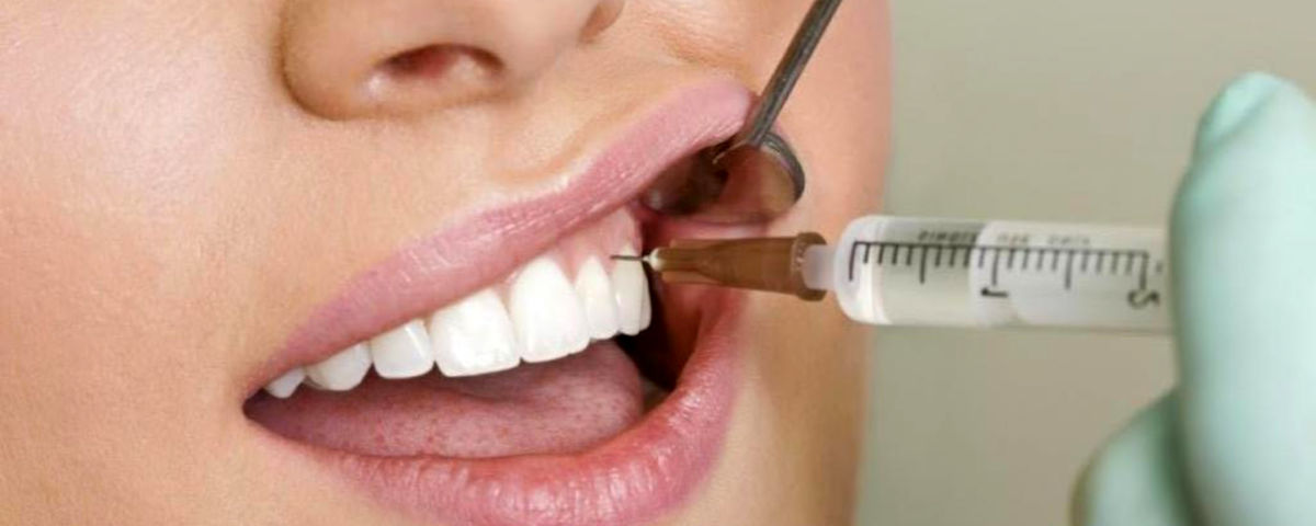 بهترین زمان برای کشیدن دندان عقل چه زمانی است؟