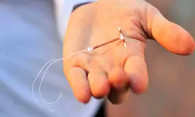 مزایای استفاده از آی یو دی، نکات مهم