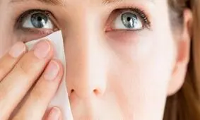 پاک کردن آرایش صورت چه اهمیتی دارد؟!